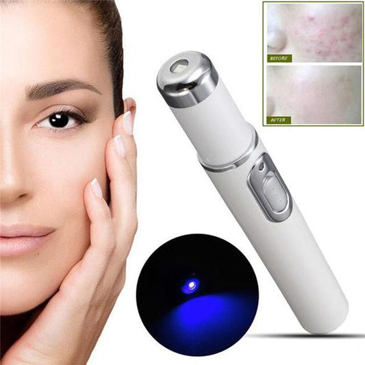 Blue Light Acne Therapy Laser Pen Soft Scar Wrinkle Removal Treatment Device Skin Care Beauty Equipment